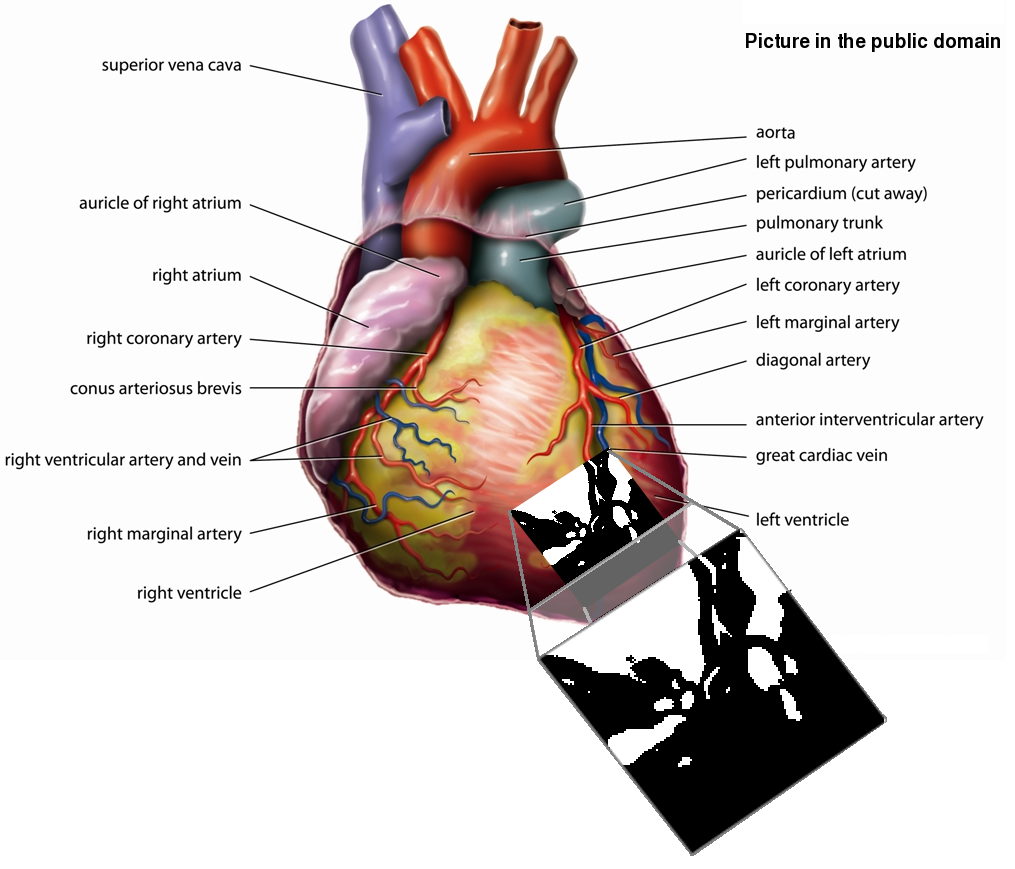 Image heart-cube-slice