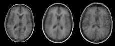 \includegraphics[%
scale=0.4]{EPS/model_cps_3.eps}