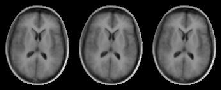 \includegraphics[%
scale=0.4]{EPS/brain_15_cps.eps}