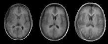 \includegraphics[%
scale=0.382]{EPS/brain_30_cps.eps}