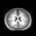 thumbs/MGH_multiple_modes_001.png