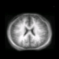 thumbs/MGH_multiple_modes_002.png
