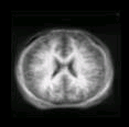 thumbs/MGH_multiple_modes_003.png