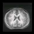thumbs/MGH_multiple_modes_004.png