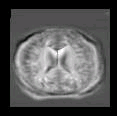 thumbs/MGH_multiple_modes_008.png
