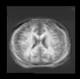 thumbs/MGH_multiple_modes_011.png