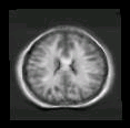 thumbs/MGH_multiple_modes_026.png