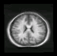 thumbs/MGH_multiple_modes_028.png
