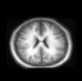 thumbs/MGH_multiple_modes_031.png