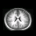 thumbs/MGH_000.png