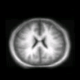thumbs/MGH_001.png