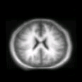 thumbs/MGH_002.png