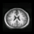 thumbs/MGH_006.png