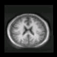 thumbs/MGH_008.png
