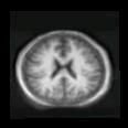 thumbs/MGH_009.png