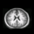 thumbs/MGH_011.png