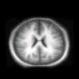 thumbs/MGH_017.png