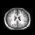 thumbs/MGH_018.png