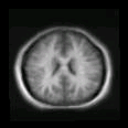 thumbs/MGH_025.png