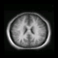 thumbs/MGH_026.png
