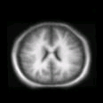 thumbs/MGH_029.png