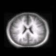 thumbs/MGH_model.png
