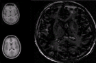 thumbs/brain-shuffle-example-7x7-neighbourhood-no-shadow.png