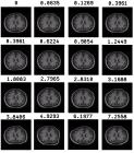 thumbs/example_warp_mangnitude_brains_16.png