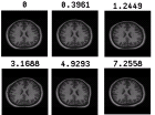 thumbs/example_warp_mangnitude_brains_6.png