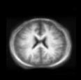 No brain deformation