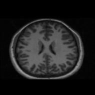 Large brain