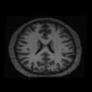 Wide brain