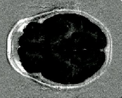 Image slice_bad_contrast