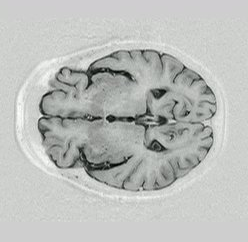 Image slice_recovered